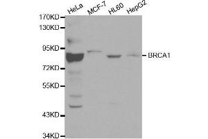 Western blot analysis of extracts of various cell lines, using BRCA1 antibody. (BRCA1 antibody  (AA 120-220))