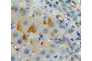 Used in DAB staining on fromalin fixed paraffin-embedded Liver tissue (CD8B antibody  (AA 22-175))