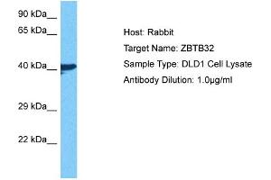 Host: Rabbit Target Name: ZBTB32 Sample Tissue: Human DLD1 Whole Cell Antibody Dilution: 1ug/ml (ZBTB32 antibody  (N-Term))