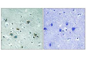 Immunohistochemical analysis of paraffin-embedded human brain tissue using CRMP-2 (Phospho-Thr509) antibody (left)or the same antibody preincubated with blocking peptide (right). (DPYSL2 antibody  (pThr509))