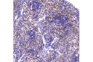 IHC analysis of GLO1 using anti-GLO1 antibody .