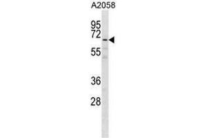 GPKOW Antibody (Center) western blot analysis in A2058 cell line lysates (35µg/lane). (GPKOW antibody  (Middle Region))