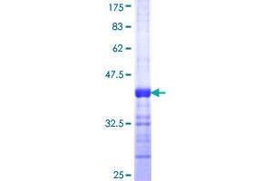 PAFAH1B1 Protein (AA 1-110) (GST tag)