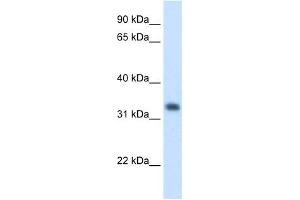 HMGCL antibody used at 1. (HMGCL antibody)