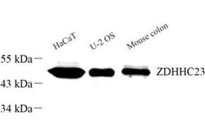 Western blot analysis of ZDHHC23 (ABIN7076281) at dilution of 1: 300 (ZDHHC23 antibody)