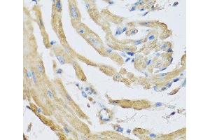 Immunohistochemistry of paraffin-embedded Mouse heart using SFRP4 Polyclonal Antibody at dilution of 1:100 (40x lens).