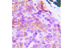 Immunohistochemistry (IHC) image for anti-BCL2-Like 11 (Apoptosis Facilitator) (BCL2L11) (N-Term) antibody (ABIN7297710)
