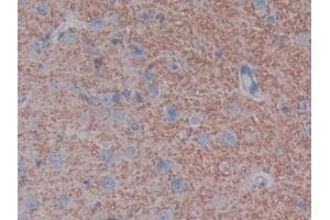 Detection of ACE2 in Rat Cerebrum Tissue using Polyclonal Antibody to Angiotensin I Converting Enzyme 2 (ACE2)