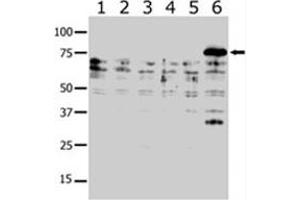 Western blot analysis of PAK6 polyclonal antibody  in lysates from transiently transfected COS-7 cells. (PAK6 antibody  (AA 131-146))