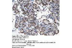 Rabbit Anti-GTF21 Antibody  Paraffin Embedded Tissue: Human Pancreas Cellular Data: Epithelial cells of pancreatic acinus Antibody Concentration: 4. (GTF2I antibody  (N-Term))