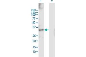 Western Blot analysis of RDHE2 expression in transfected 293T cell line by RDHE2 MaxPab polyclonal antibody. (SDR16C5 antibody  (AA 1-309))