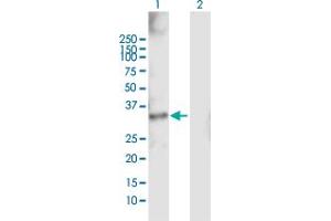 Western Blot analysis of RDHE2 expression in transfected 293T cell line by RDHE2 MaxPab polyclonal antibody. (SDR16C5 antibody  (AA 1-309))