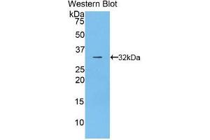 Western blot analysis of the recombinant protein. (CD2AP antibody  (AA 368-623))