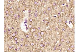 Paraformaldehyde-fixed, paraffin embedded Mouse brain Antigen retrieval by boiling in sodium citrate buffer (pH6. (TUBB antibody)