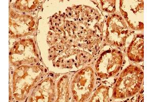 IHC image of ABIN7173825 diluted at 1:400 and staining in paraffin-embedded human kidney tissue performed on a Leica BondTM system. (TNFRSF1A antibody  (AA 263-468))