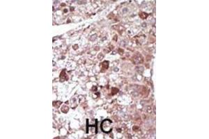 Immunohistochemistry (IHC) image for anti-phosphoenolpyruvate Carboxykinase 1 (Soluble) (PCK1) antibody (ABIN3003679)
