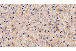 Detection of TSLP in Human Liver Tissue using Monoclonal Antibody to Thymic Stromal Lymphopoietin (TSLP) (Thymic Stromal Lymphopoietin antibody  (AA 29-159))