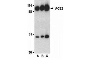 Western Blotting (WB) image for anti-Angiotensin I Converting Enzyme 2 (ACE2) (C-Term) antibody (ABIN1030215) (ACE2 antibody  (C-Term))