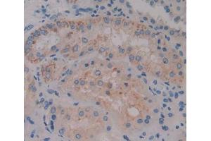 #VALUE! (ACOX1 antibody  (AA 210-409))