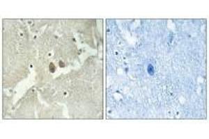 Immunohistochemistry analysis of paraffin-embedded human brain tissue using NSG2 antibody.