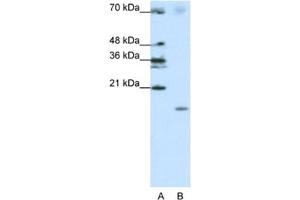 Western Blotting (WB) image for anti-Signal Recognition Particle 19kDa (SRP19) antibody (ABIN2462141) (SRP19 antibody)
