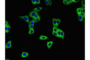 Immunofluorescent analysis of HepG2 cells using ABIN7170219 at dilution of 1:100 and Alexa Fluor 488-congugated AffiniPure Goat Anti-Rabbit IgG(H+L) (SLC28A3 antibody  (AA 1-102))