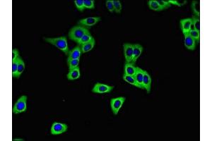 Immunofluorescent analysis of HepG2 cells using ABIN7170219 at dilution of 1:100 and Alexa Fluor 488-congugated AffiniPure Goat Anti-Rabbit IgG(H+L) (SLC28A3 antibody  (AA 1-102))