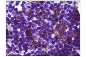 Immunohistochemistry (IHC) image for anti-B Lymphoid Tyrosine Kinase (BLK) (truncated) antibody (ABIN2464016) (BLK antibody  (truncated))