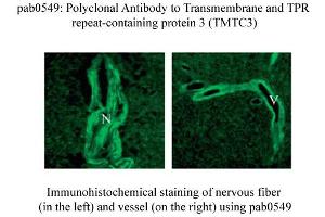 Image no. 1 for anti-Transmembrane and Tetratricopeptide Repeat Containing 3 (TMTC3) (C-Term) antibody (ABIN347751) (TMTC3 antibody  (C-Term))