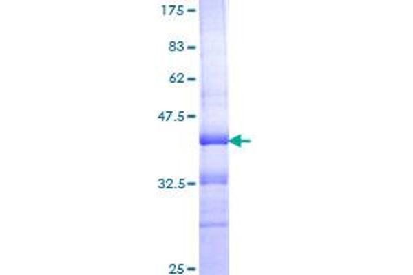 ITGA4 Protein (AA 98-207) (GST tag)