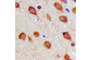 Immunohistochemical analysis of Aurora A (pT288) staining in human brain formalin fixed paraffin embedded tissue section. (Aurora A antibody  (pSer288))