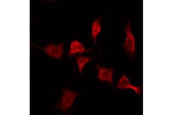 OR2T11 antibody  (Internal Region)