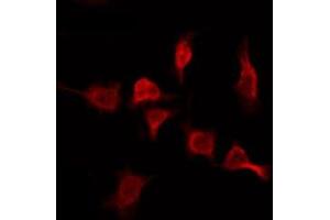 ABIN6276078 staining MCF7 by IF/ICC. (OR2T11 antibody  (Internal Region))