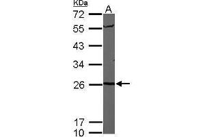 WB Image Sample (50 ug of whole cell lysate) A: Mouse brain 12% SDS PAGE antibody diluted at 1:1000 (PSMA6 antibody  (Center))
