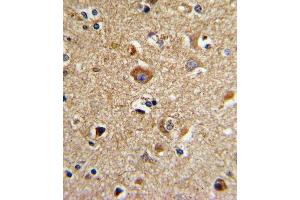 Formalin-fixed and paraffin-embedded human brain tissue with CD81 Antibody (C-term), which was peroxidase-conjugated to the secondary antibody, followed by DAB staining.
