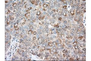 Immunohistochemical staining of paraffin-embedded Human liver tissue using anti-BCL10 mouse monoclonal antibody. (BCL10 antibody)