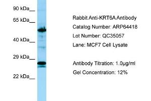 Western Blotting (WB) image for anti-Keratin 6A (KRT6A) (C-Term) antibody (ABIN2774397) (KRT6A antibody  (C-Term))