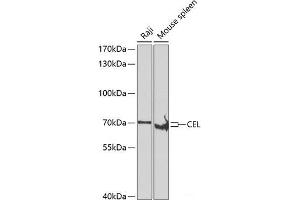 Western blot analysis of extracts of various cell lines using CEL Polyclonal Antibody at dilution of 1:500. (Cholesterol Esterase antibody)
