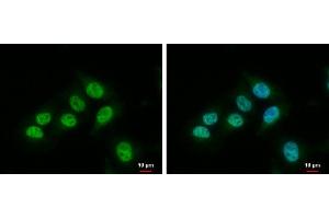 Immunofluorescence (IF) image for anti-Heme Oxygenase (Decycling) 1 (HMOX1) antibody (ABIN2854952)