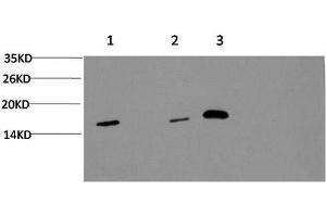 Western Blot analysis of 1) Hela, 2) 3T3, 3) Rat brain using MAP1LC3A Monoclonal Antibody at dilution of 1:1000. (MAP1LC3A antibody)