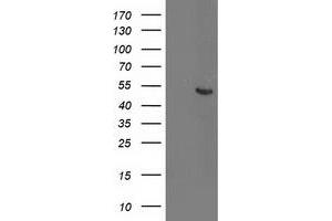 HEK293T cells were transfected with the pCMV6-ENTRY control (Left lane) or pCMV6-ENTRY ACY1 (Right lane) cDNA for 48 hrs and lysed. (Aminoacylase 1 antibody)