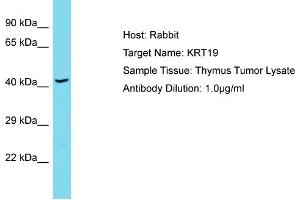 Host: Rabbit Target Name: KRT19 Sample Type: Thymus Tumor lysates Antibody Dilution: 1. (Cytokeratin 19 antibody  (Middle Region))