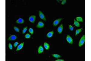 Immunofluorescent analysis of A549 cells using ABIN7159245 at dilution of 1:100 and Alexa Fluor 488-congugated AffiniPure Goat Anti-Rabbit IgG(H+L) (MLANA antibody  (AA 48-118))
