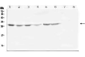 Western blot analysis of SCN4B using anti-SCN4B antibody (ABIN6719653).
