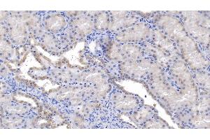Detection of PRDX5 in Human Kidney Tissue using Polyclonal Antibody to Peroxiredoxin 5 (PRDX5)