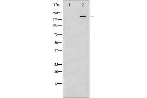 Western blot analysis of IRS-1 phosphorylation expression in K562 whole cell lysates,The lane on the left is treated with the antigen-specific peptide. (IRS1 antibody  (pSer307))