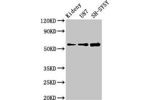 Western Blot Positive WB detected in: Mouse kidney tissue, U87 whole cell lysate, SH-SY5Y whole cell lysate All lanes: KCNAB1 antibody at 3. (KCNAB1 antibody  (AA 287-401))