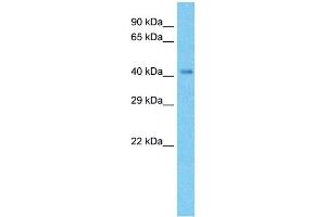 Host:  Rabbit  Target Name:  NDUFV1  Sample Type:  Fetal liver Cell lysates  Antibody Dilution:  1. (NDUFV1 antibody  (N-Term))