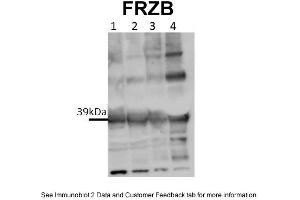 WB Suggested Anti-FRZB Antibody Titration: 0. (FRZB antibody  (Middle Region))