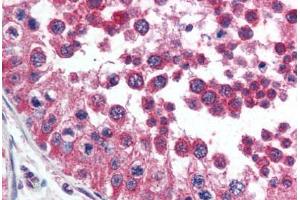 Human Testis (formalin-fixed, paraffin-embedded) stained with HAVCR1 antibody ABIN292372 at 2. (HAVCR1 antibody  (AA 200-300))